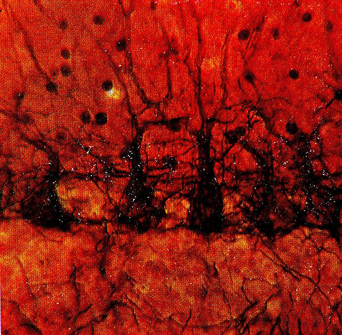 Б Рис. 7. А. Взаимосвязь между лиановидным волокном (темные участки) и дендритом (D) клетки Пуркинье. Фото K. Uchizono. S – возбуждающие синапсы, F – тормозящие синапсы, LF – лиановидное волокно. Б. Сеть из пяти клеток Пуркинье, сомы и начальные участки дендритов которых оплетены ветвями аксона корзинчатой клетки (Фото В. В. Коротченко).